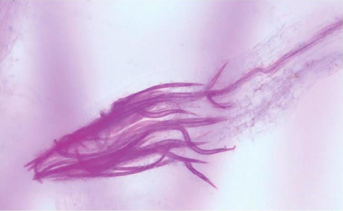 Juvenile nematodes shown in tomato root tips after infestation