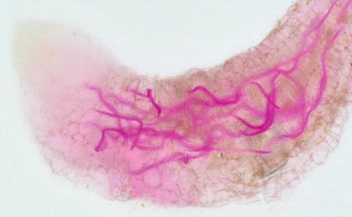 Juvenile nematodes shown in tomato root tips after infestation